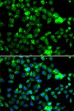 NAA20 Antibody in Immunocytochemistry (ICC/IF)