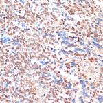 NAA20 Antibody in Immunohistochemistry (Paraffin) (IHC (P))