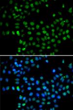 EAF2 Antibody in Immunocytochemistry (ICC/IF)