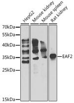 EAF2 Antibody in Western Blot (WB)