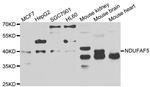 NDUFAF5 Antibody in Western Blot (WB)