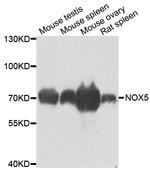 NOX5 Antibody in Western Blot (WB)