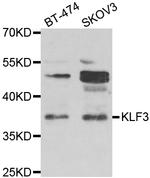 KLF3 Antibody in Western Blot (WB)