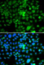 NAP1L3 Antibody in Immunocytochemistry (ICC/IF)