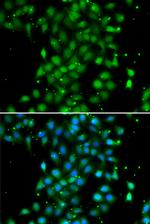 UBE2Z Antibody in Immunocytochemistry (ICC/IF)