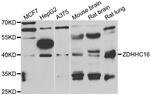 ZDHHC16 Antibody in Western Blot (WB)