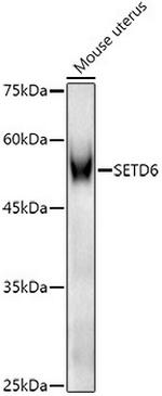 SETD6 Antibody in Western Blot (WB)