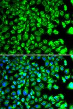 C10orf32 Antibody in Immunocytochemistry (ICC/IF)