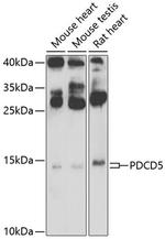 PDCD5 Antibody in Immunocytochemistry (ICC/IF)