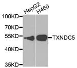 TXNDC5 Antibody in Western Blot (WB)