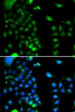 UBE2J2 Antibody in Immunocytochemistry (ICC/IF)