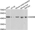 GSDMB Antibody in Western Blot (WB)