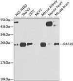 RAB1B Antibody in Western Blot (WB)