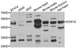 COX10 Antibody in Western Blot (WB)