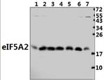 eIF5A2 Antibody in Western Blot (WB)