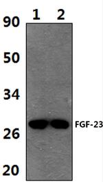 FGF23 Antibody in Western Blot (WB)