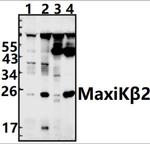 KCNMB2 Antibody in Western Blot (WB)