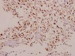 NDUFS5 Antibody in Immunohistochemistry (Paraffin) (IHC (P))