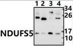 NDUFS5 Antibody in Western Blot (WB)