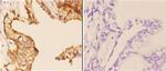 WIPF1 Antibody in Immunohistochemistry (Paraffin) (IHC (P))