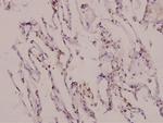 MATK Antibody in Immunohistochemistry (Paraffin) (IHC (P))