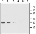 proGDNF Antibody in Western Blot (WB)