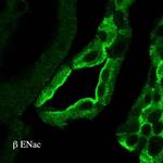 SCNN1B Antibody in Immunohistochemistry (IHC)