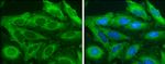 Acetyl-CoA Carboxylase Antibody in Immunocytochemistry (ICC/IF)