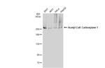 Acetyl-CoA Carboxylase Antibody in Western Blot (WB)