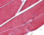 Skeletal Muscle Actin Antibody in Immunohistochemistry (Paraffin) (IHC (P))