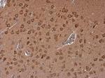 ADORA2B Antibody in Immunohistochemistry (Paraffin) (IHC (P))