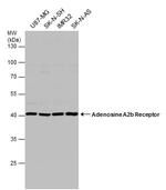 ADORA2B Antibody in Western Blot (WB)