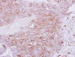 RhoC Antibody in Immunohistochemistry (Paraffin) (IHC (P))