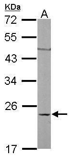 RhoC Antibody in Western Blot (WB)