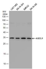 ASCL1 Antibody in Western Blot (WB)