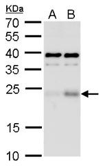 ATF3 Antibody in Western Blot (WB)