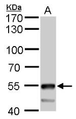 ATP6V1B2 Antibody in Western Blot (WB)