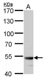 ATP6V1B2 Antibody in Western Blot (WB)