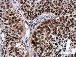 Phospho-ATR (Thr1989) Antibody in Immunohistochemistry (Paraffin) (IHC (P))