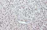 Phospho-ATR (Thr1989) Antibody in Immunohistochemistry (Paraffin) (IHC (P))