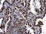 Phospho-ATR (Thr1989) Antibody in Immunohistochemistry (Paraffin) (IHC (P))