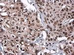 Phospho-ATR (Thr1989) Antibody in Immunohistochemistry (Paraffin) (IHC (P))