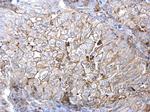 Axl Antibody in Immunohistochemistry (Paraffin) (IHC (P))