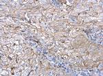 Axl Antibody in Immunohistochemistry (Paraffin) (IHC (P))