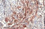 Carbonic Anhydrase IX Antibody in Immunohistochemistry (Paraffin) (IHC (P))