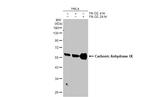 Carbonic Anhydrase IX Antibody in Western Blot (WB)