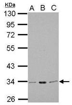 CDK1 Antibody in Western Blot (WB)