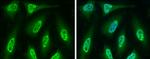 Cdc6 Antibody in Immunocytochemistry (ICC/IF)