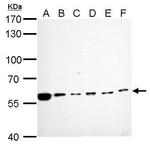 Cdc6 Antibody in Western Blot (WB)