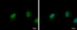 CDK6 Antibody in Immunocytochemistry (ICC/IF)